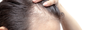 O papel do Zinco na queda de cabelo | Blog Nutrify
